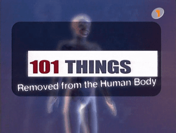 101 Things Removed from the Human Body 101 Things Removed from the Human Body Wikipedia