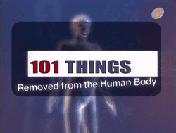 101 Things Removed from the Human Body httpsuploadwikimediaorgwikipediaenthumb2