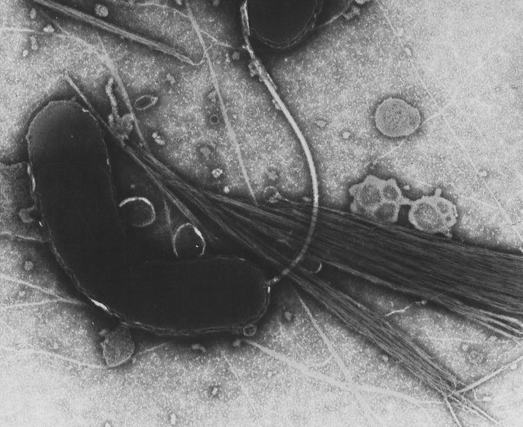 1863–75 cholera pandemic