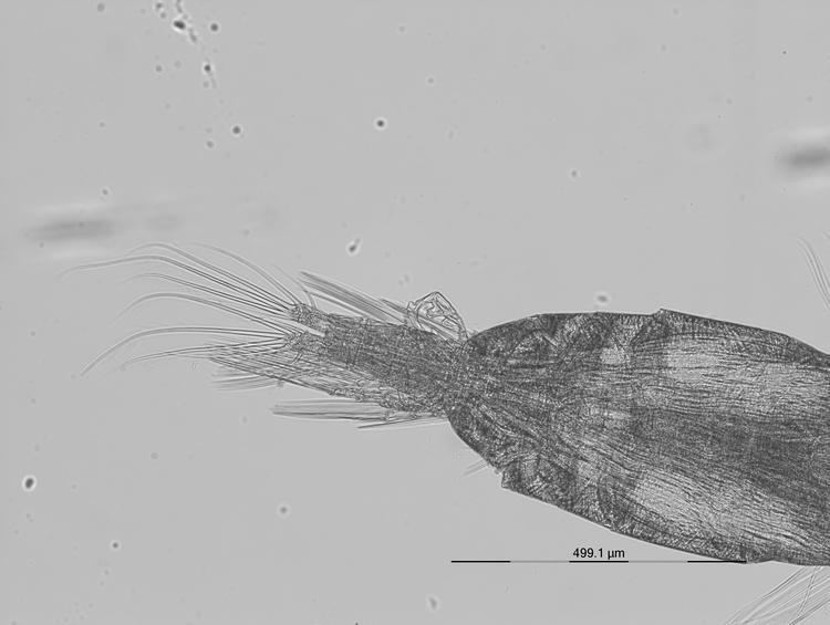 Acartia clausi Acartia clausi metacopepod