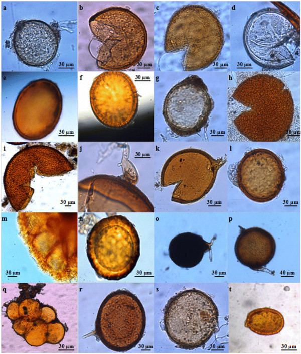 Acaulospora Micromorphology of arbuscular mycorrhizal fungi morphotypes
