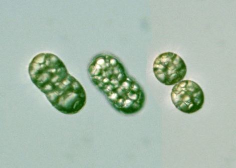 Achromatium Achromatium oxaliferum