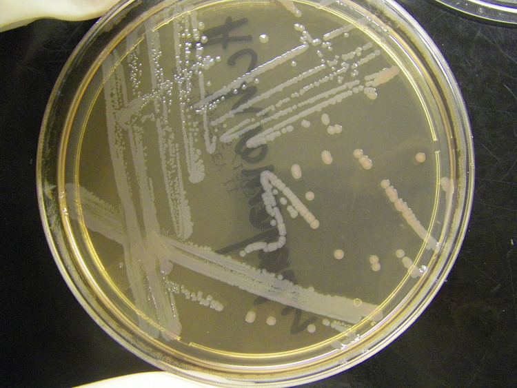Achromobacter Achromobacter spp Achromobacter spp MAC NO NYME Flickr