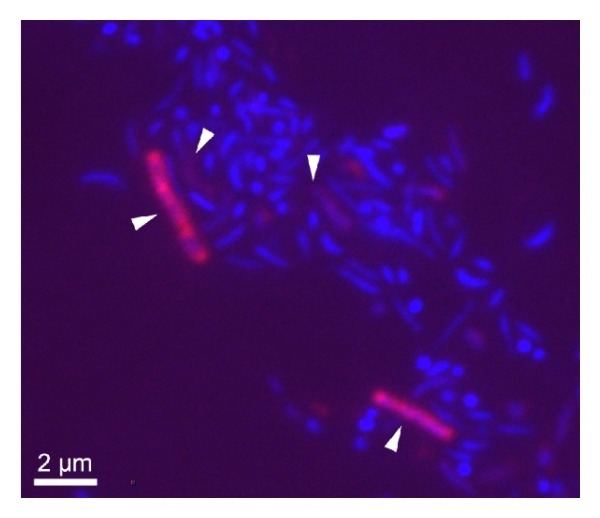 Acidobacteria Composite DAPICy3 FISH detection of Acidobacteria in