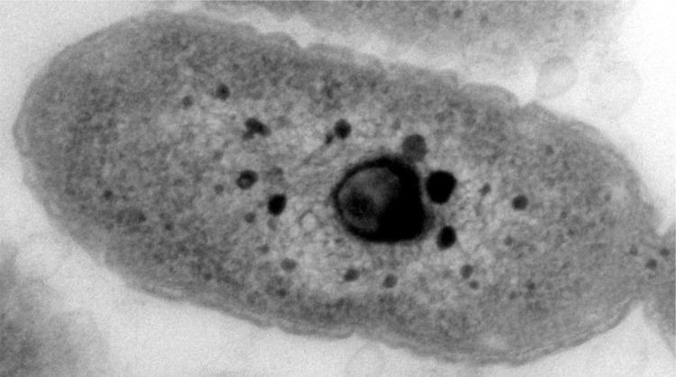 Acidobacteria Complete genome sequence of Granulicella tundricola type strain