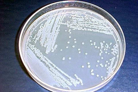 Acidovorax citrulli wwwapsnetorgedcenterintropplessonsprokaryote