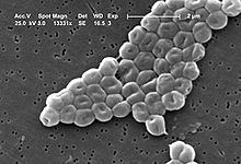 Acinetobacter httpsuploadwikimediaorgwikipediacommonsthu