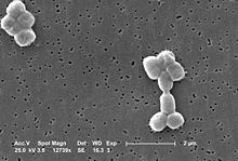 Acinetobacter baumannii httpsuploadwikimediaorgwikipediacommonsthu