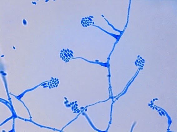 Acremonium Fun With Microbiology What39s Buggin39 You Acremonium species