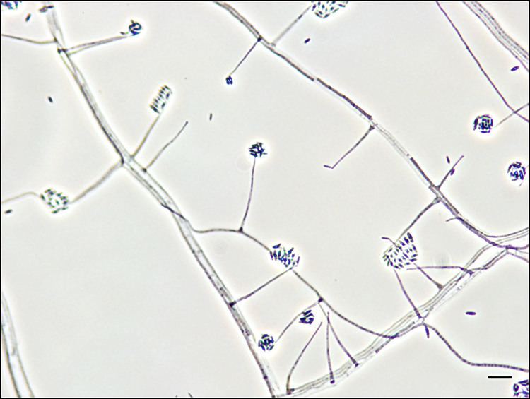 Acremonium Mould Compendium Acremonium spp INSPQ Institut national de