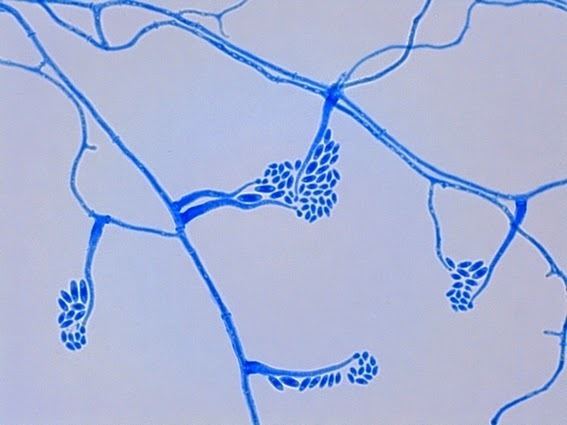 Acremonium Fun With Microbiology What39s Buggin39 You Acremonium species