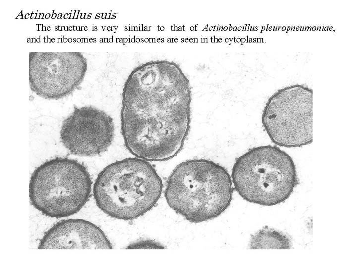 Actinobacillus NIAHNIAH Pathogenic Organisms Observed by Electron Microscope