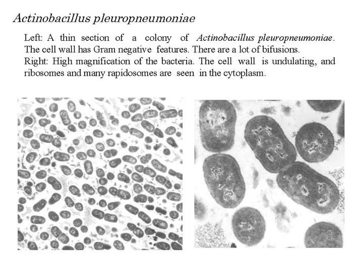 Actinobacillus pleuropneumoniae NIAHNIAH Pathogenic Organisms Observed by Electron Microscope