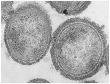 Actinobacillus pleuropneumoniae Actinobacillus pleuropneumoniae in Swine