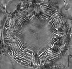 Actinocyclus normanii Actinocyclus normanii Diatoms of the United States