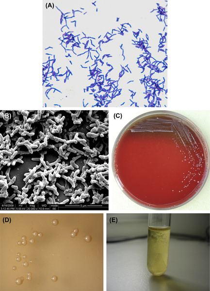 Actinomyces naeslundii Supragingival Microbes Pocket Dentistry