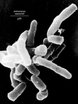 Actinomyces naeslundii Actinomyces naeslundii MicrobeWiki