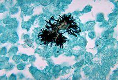 Actinomyces naeslundii httpsuploadwikimediaorgwikipediacommonsthu