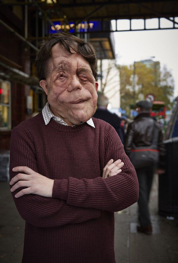 Adam Pearson (actor) Disfigured actor Adam Pearson told he quotshould have be