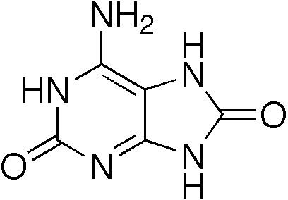 Adenine phosphoribosyltransferase deficiency