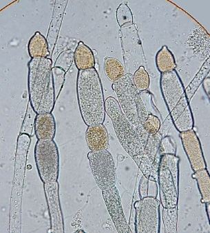 Allomyces plantphysinfoorganismallechtmlimagesallomyces