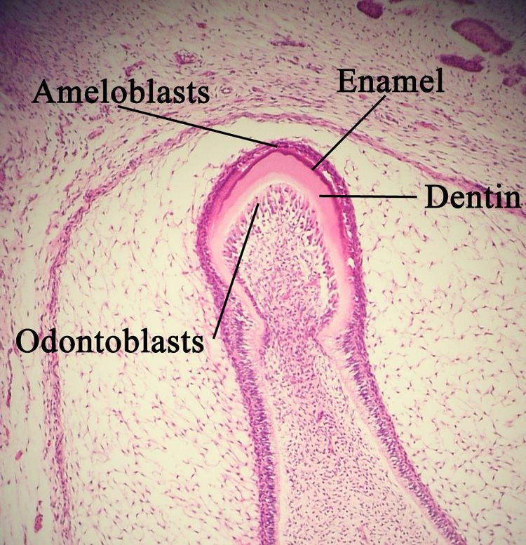 Ameloblast