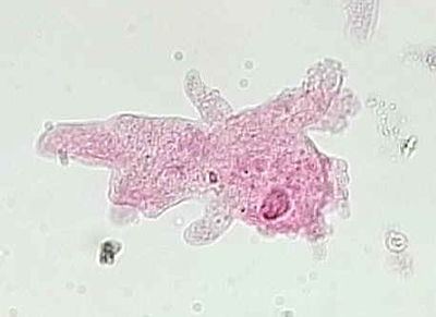 Amoeba proteus Amoeba proteus MicrobeWiki