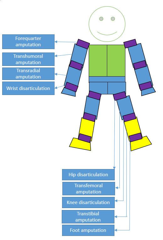 Amputee sports classification