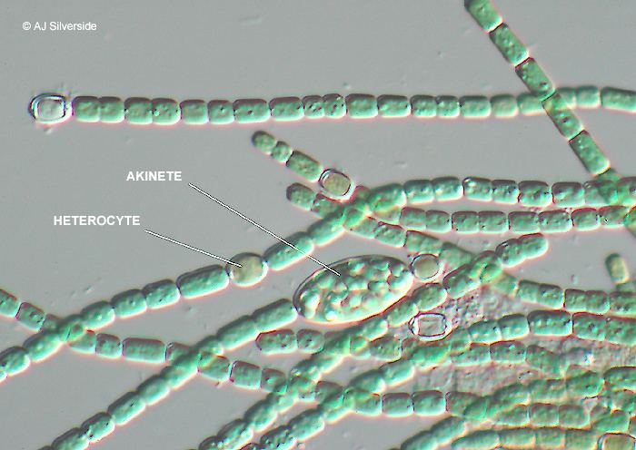 Anabaena under microscope