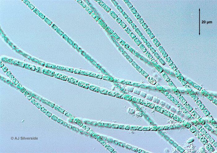 Anabaena under microscope