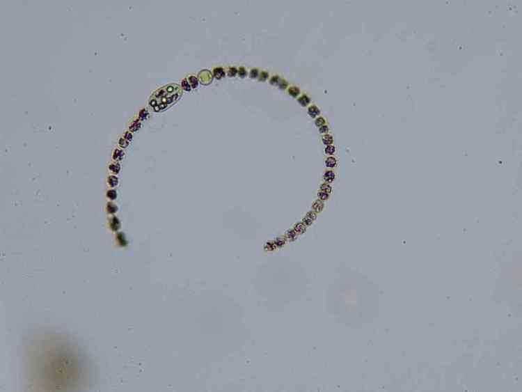 Anabaena circinalis Anabaena image information