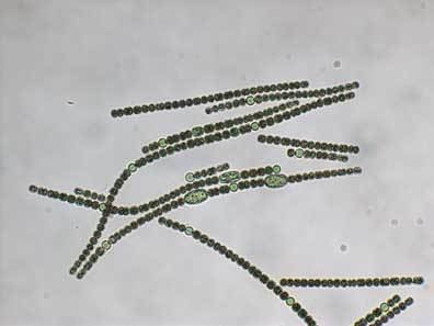 Anabaena circinalis Anabaena circinalis