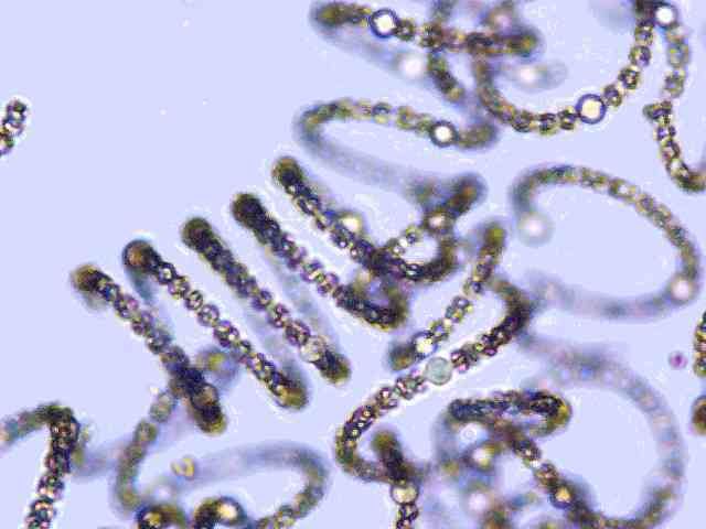 Anabaena circinalis ledlyt webcam photomicrography