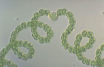 Anabaena flos-aquae