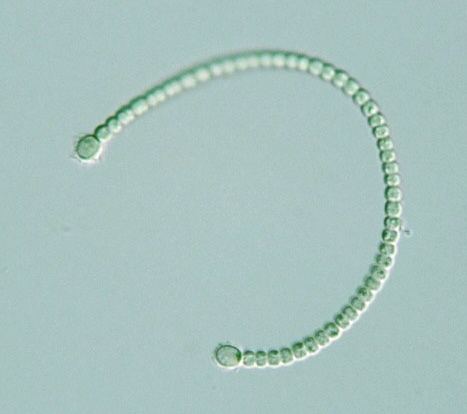 Anabaenopsis Prokaryote Nostocales Anabaenopsis