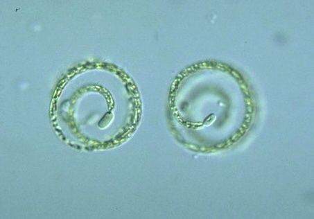 Anabaenopsis Prokaryote Nostocales Anabaenopsis flosaquae