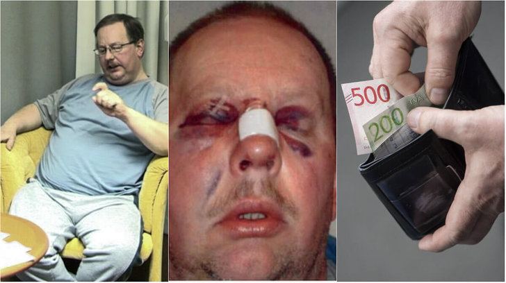 On the left, Anders Eklund wearing eyeglasses while sitting on a yellow couch. In the middle, Anders Eklund with a black eye and a band-aid on his nose. On the right, hands holding a wallet with money.
