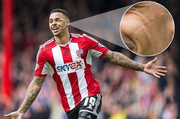 Andre Gray Andre Gray says being stabbed in the face made him 39grow