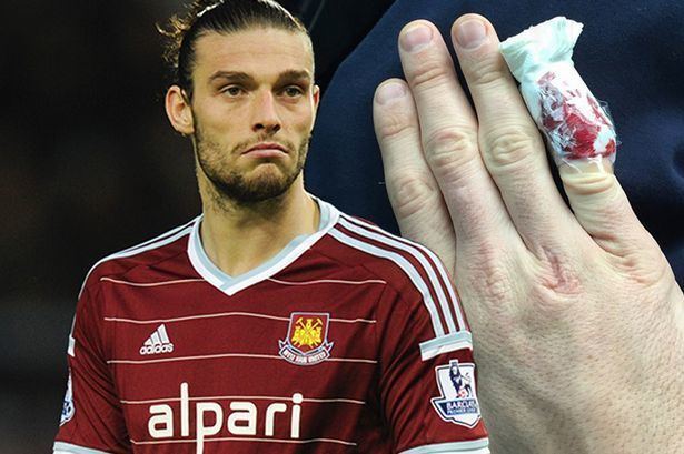 Andy Carroll Andy Carroll is injured again and you39ll never guess