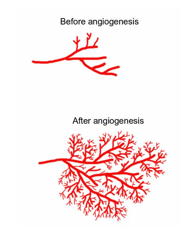 Angiogenesis blogsscientificamericancomguestblogfiles2013