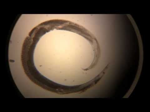 Anguina (nematode) Anguina pacificae Poa annua stem gall nematode YouTube