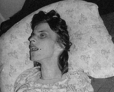 Anneliese Michel lying on the bed with a skinny face and her mouth is open while wearing a blouse