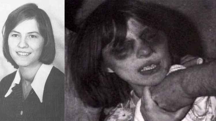 On the left, Anneliese Michel smiling with shoulder-length hair and wearing a blouse with a collar. On the right, Anneliese holding the hand of a man and a cloth while she has bruises around her eyes and a skinny face