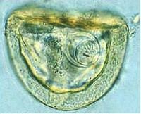 Anoplocephala parasitipedianetimagesstoriesendoparaCestode