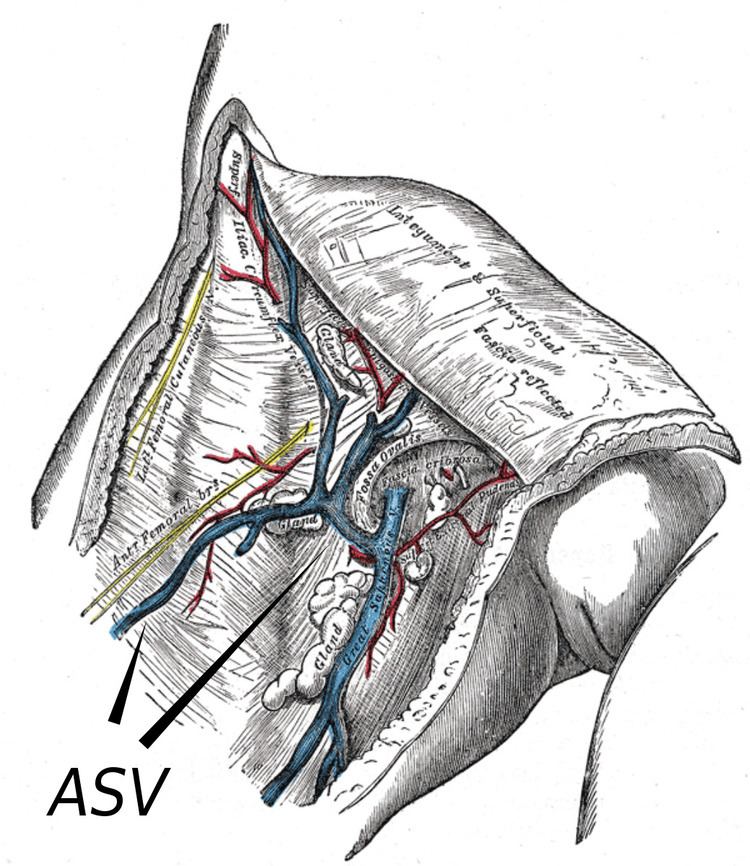 Anterior accessory saphenous vein