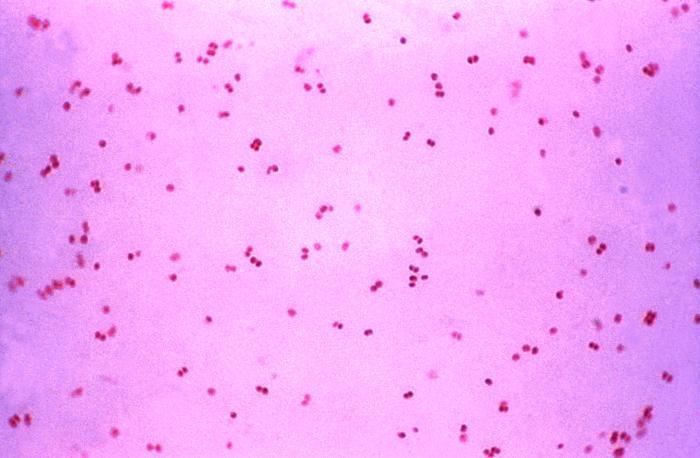Antibiotic resistance in gonorrhea