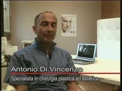 Antonio di Vincenzo Dr Antonio Di Vincenzo Mastopessi YouTube