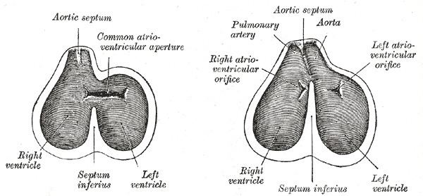 Aorticopulmonary septum