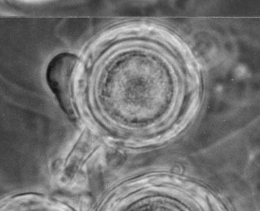 Aphanomyces euteiches Article Images Aphanomyces11