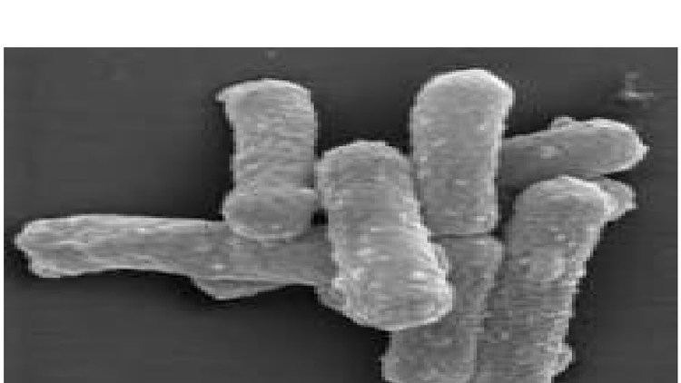 Scanning electron micrograph of Hydrogenobacter thermophilus